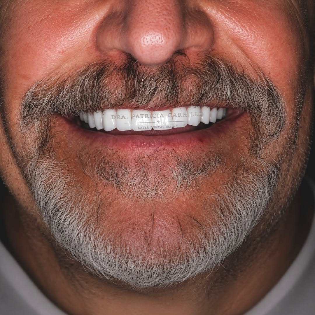 Sonrisa rehabilitada, caso Dra. Patricia Carrillo